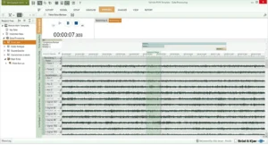 Інтерфейс BK Connect 8402 з переглядом сигналів і Time Review | Anwit
